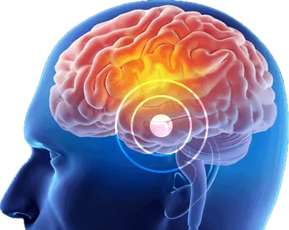 the brain song